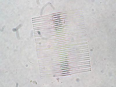 fragilaria crotonensis