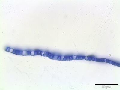 sphagnum angustifolium stammblatt querschnitt