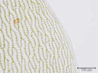 sphagnum auriculatum stammblatt randzellen