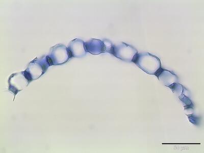 sphagnum fimbriatum astblatt querschnitt