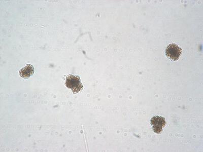 botrycoccus braunii