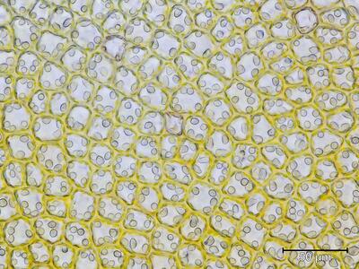 barbilophozia floerkei zellen
