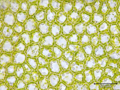 barbilophozia lycopodioides zellen