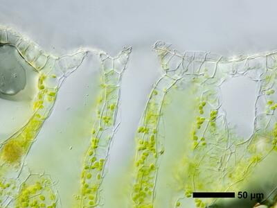 asterella gracilis swe thallus air pore cross section
