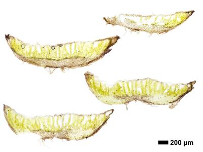asterella gracilis swe thallus cross section
