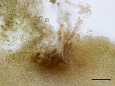 asterella lindenbergiana archegonienstand quer