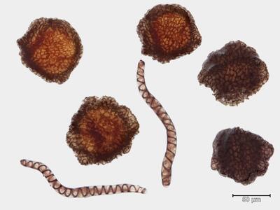 asterella lindenbergiana sporen elateren