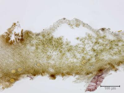 asterella lindenbergiana thallus quer detail