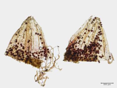 asterella lindenbergiana weibliches koepfchen pseudoperianth