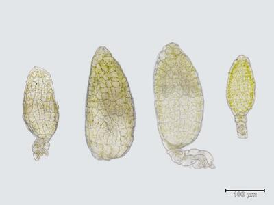 asterella saccata antheridien
