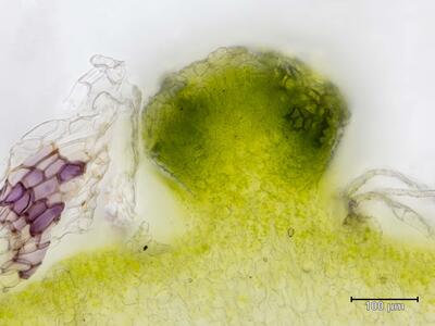 asterella saccata archegonienstand quer