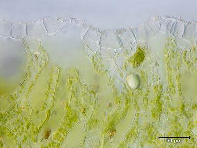 asterella saccata atempore quer