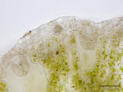 mannia androgyna archegonium halskanal 1