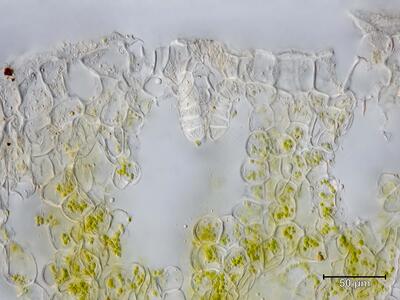 mannia androgyna archegonium halskanal 2