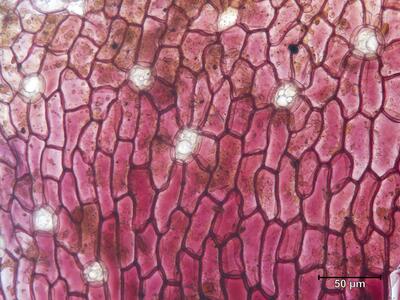 mannia androgyna rhizodermis