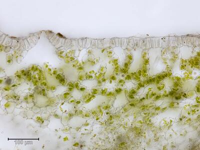 mannia androgyna thallus atempore quer