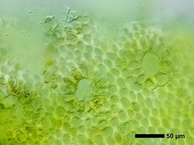 mannia fragrans swe thallus air pore anterior view