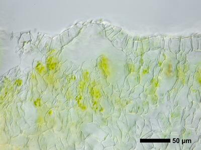 mannia fragrans swe thallus air pore cross section