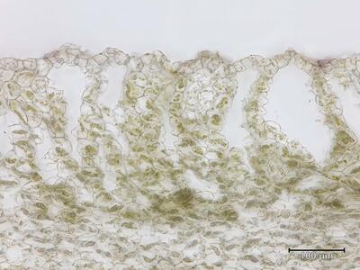 mannia gracilis thallus assimilationsgewebe quer