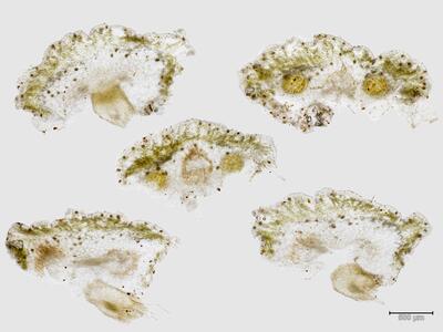 mannia pilosa weibliches koepfchen quer