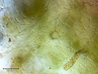 mannia triandra atempore aufsicht