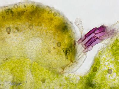 mannia triandra frisch archegonium
