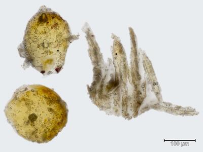plagiochasma rupestre antheridien
