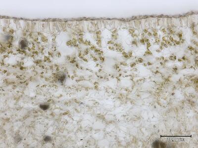 plagiochasma rupestre assimilationsgewebe quer