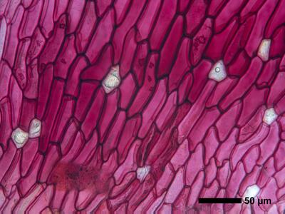 reboulia hemisphaerica ssp hemisphaerica swe ventral scales oelzellen