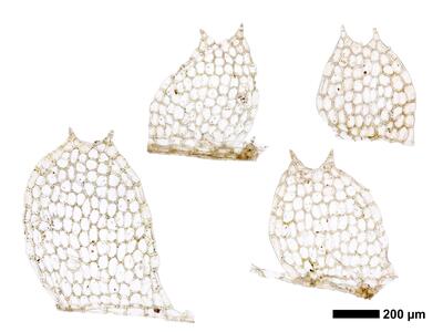 calypogeia arguta 1 flankenblatt