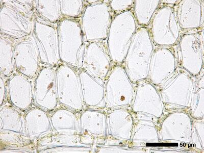 calypogeia arguta 1 flankenblatt blattbasis