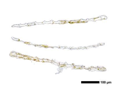 calypogeia arguta 1 flankenblatt quer