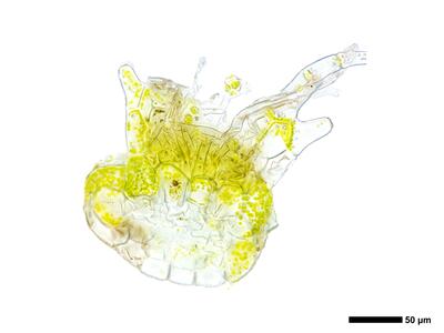 calypogeia arguta 3 unterblatt