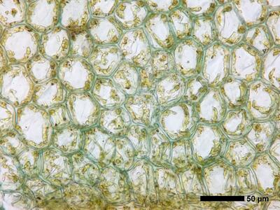 calypogeia azurea 1 flankenblatt blattbasis