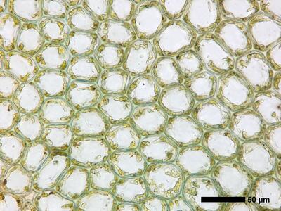 calypogeia azurea 1 flankenblatt blattmitte