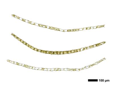 calypogeia azurea 1 flankenblatt quer