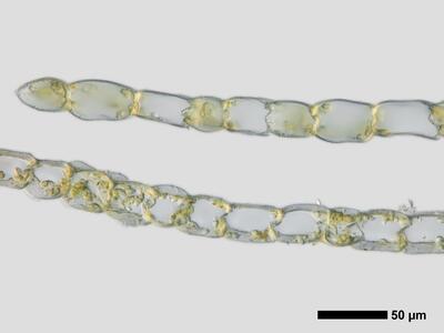 calypogeia azurea 1 flankenblatt quer detail