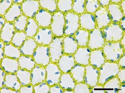 calypogeia azurea 2 flankenblatt blattmitte