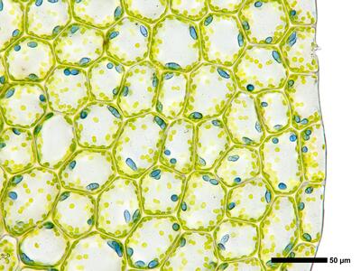 calypogeia azurea 2 flankenblatt blattrand