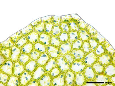 calypogeia azurea 2 flankenblatt blattspitze