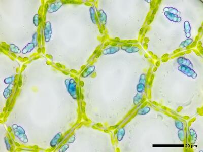 calypogeia azurea 2 flankenblatt zellen oelkoerper
