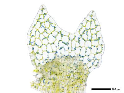 calypogeia azurea 2 unterblatt detail