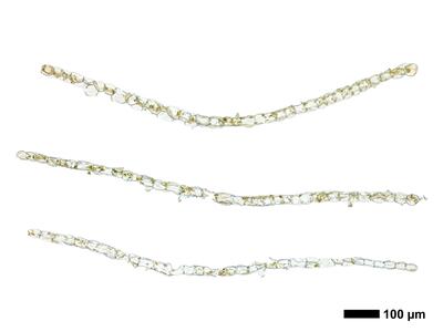 calypogeia fissa 1 flankenblatt quer