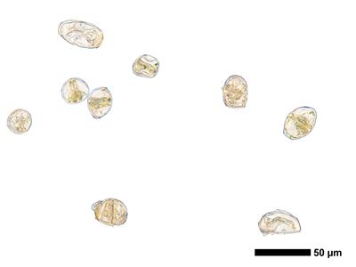 calypogeia integristipula 1 brutgemmen