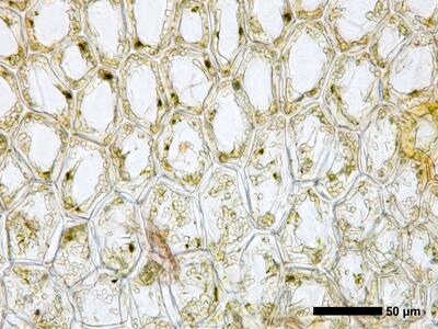 calypogeia integristipula 1 flankenblatt blattbasis