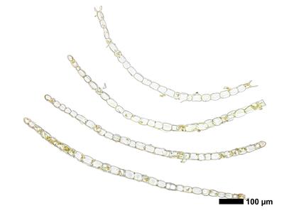 calypogeia integristipula 1 flankenblatt quer