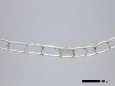 calypogeia integristipula 1 flankenblatt quer detail