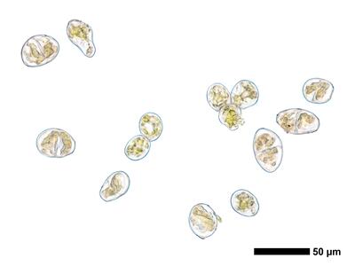 calypogeia muelleriana 1 brutgemmen