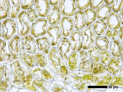 calypogeia muelleriana 1 flankenblatt blattbasis