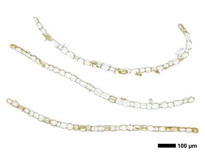 calypogeia muelleriana 1 flankenblatt quer